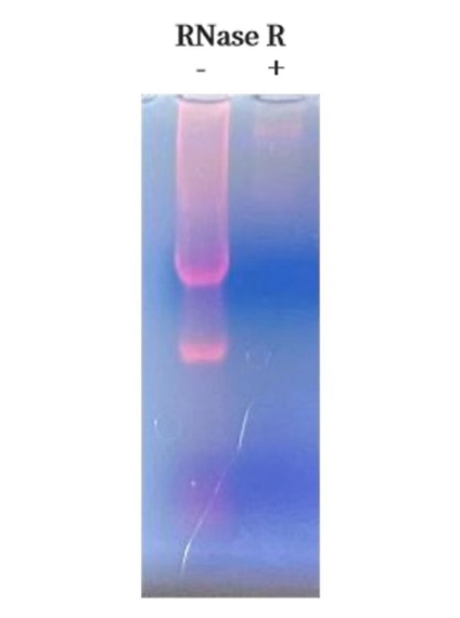 results of digesting total human RNA by Recombinant RNase R